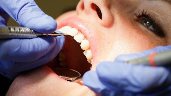 $150 (Self Pay) New Patient Exam, X-Rays, Regular Cleaning (excludes periodontal disease)